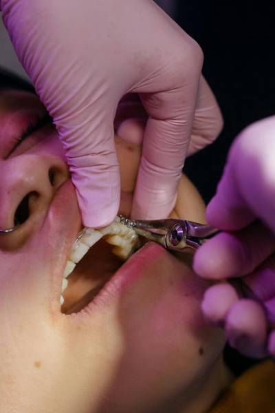 L'Intérêt d'un Suivi Ostéopathique Jumelé au Traitement d'Orthodontie : Une Approche Holistique pour une Santé Bucco-Dentaire Optimale, votre ostéopathe à Allauch